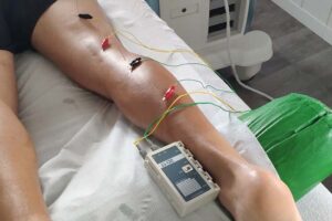 La neuromodulación es un tratamiento que se aplica en fisioterapia muy efectivo para el dolor crónico.