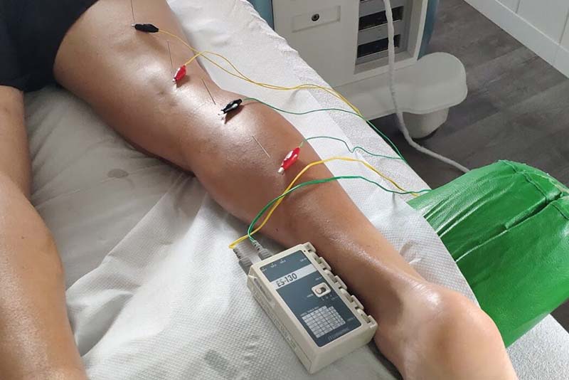 La neuromodulación es un tratamiento que se aplica en fisioterapia muy efectivo para el dolor crónico.